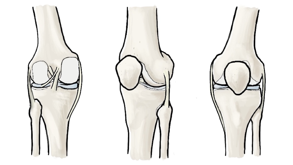Knee Joint thumbnail